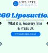 What is 360 Liposuction