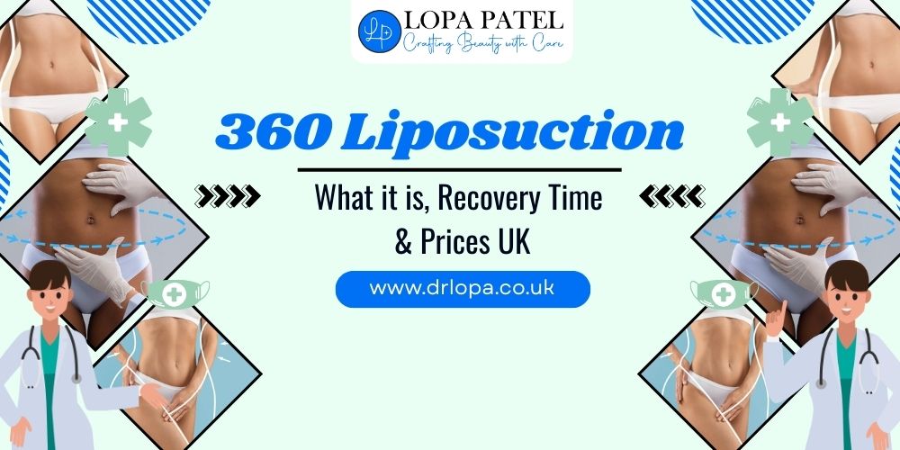 What is 360 Liposuction