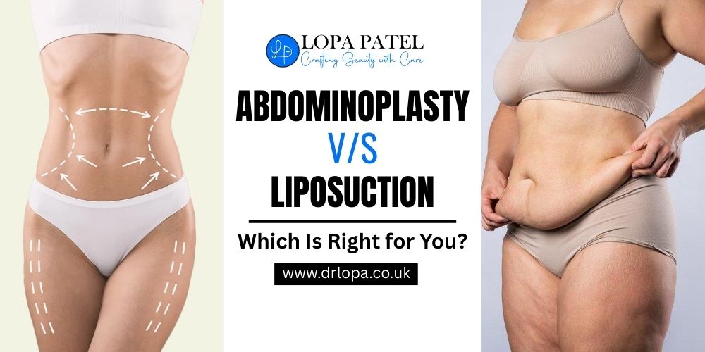 Abdominoplasty vs Liposuction