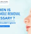 Surgical Mole Removal