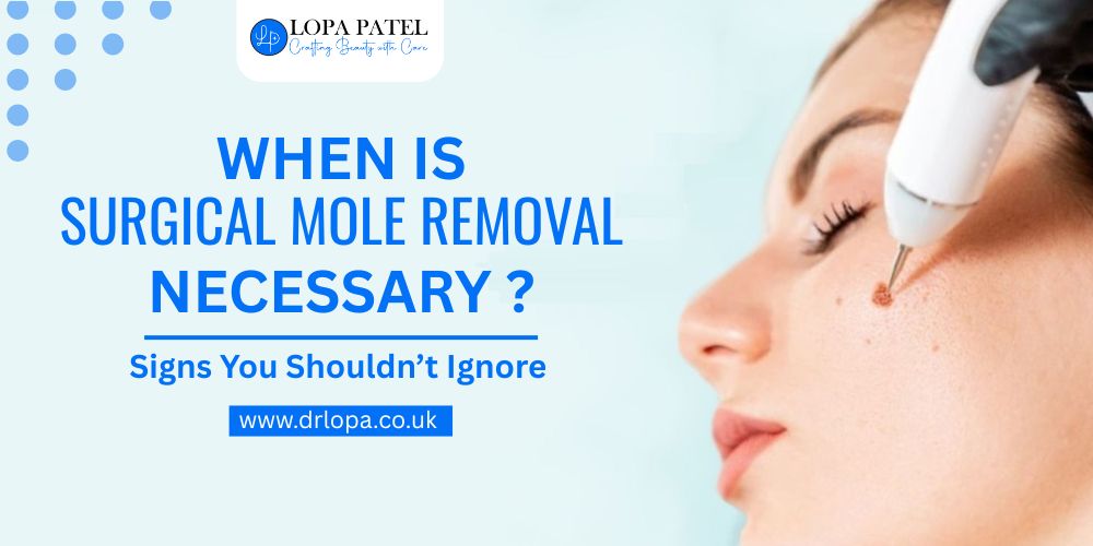 Surgical Mole Removal