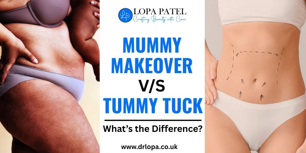 MUMMY MAKEOVER VS TUMMY TUCK