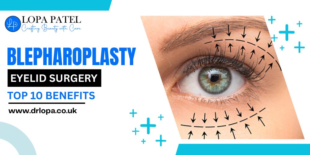 Benefits of Blepharoplasty