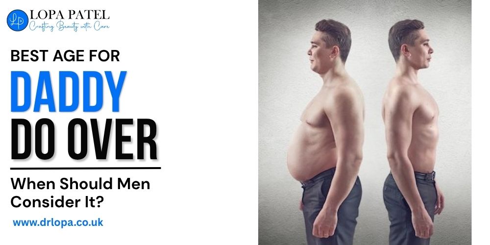 Best age for Daddy Do Over Surgery