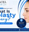 What is Otoplasty Surgery