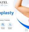 Brachioplasty Surgery Cost, Procedure & Recovery Timeline
