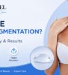 Preserve Breast Augmentation
