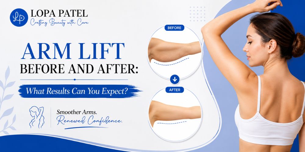 Arm Lift Before and After