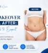 Mummy Makeover Before & After